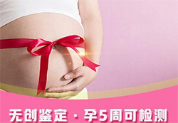 昆明需要怎么办理胎儿亲子鉴定